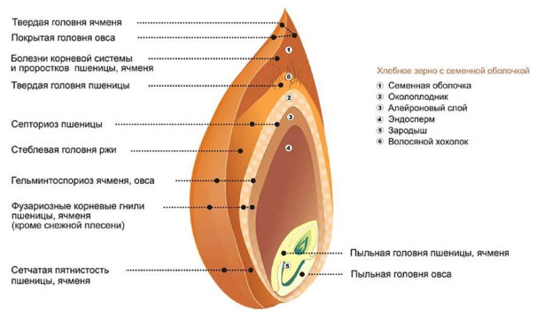 Локализация болезней